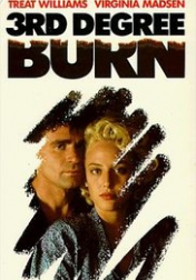Third Degree Burn 1989